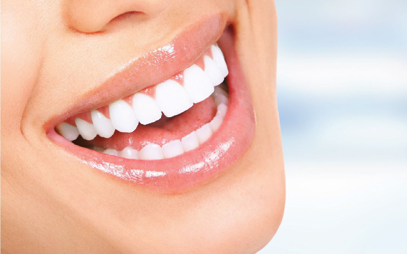 Clareamento Dental
